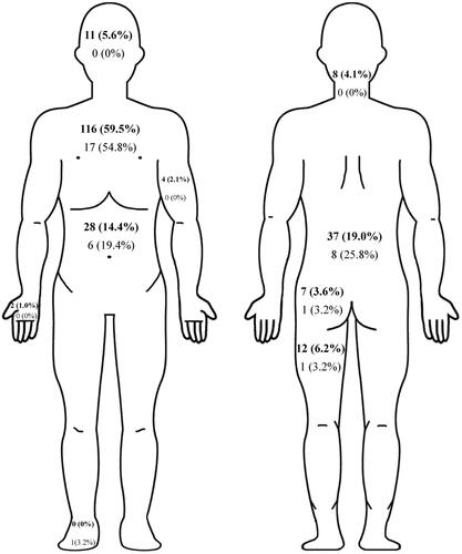 Figure 1. Locations of pain in patients with stable COPD (bold) and AECOPD. Abbreviations: COPD, chronic obstructive pulmonary disease; AECOPD, acute exacerbation of COPD.