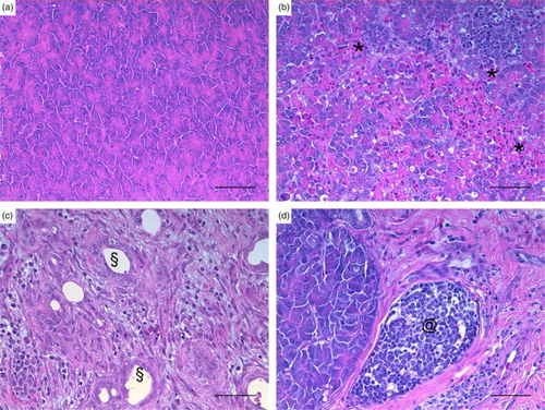 Figure 1. Turkey, pancreas, histological lesions at different infection phases with AIVs. (a) The normal anatomy of the pancreas in a control turkey. During the early phase (4–7 DPI) (b) an acute necrotizing pancreatitis with heterophilic interstitial inflammation (*), oedema, and necrosis was evident, whereas the main lesions of the intermediate phase (8–17 DPI) (c) consisted of a chronic fibrosing pancreatitis with ductular hyperplasia (§). During the late phase (39 DPI), (d) fibrosis and lymphoplasmacytic infiltrate (@) were observed together with areas of normal pancreatic tissue. ((a) case no. 30, (b) case no. 8, (c) case no. 20, (d) case no. 26. HE). bar = 50 µm.
