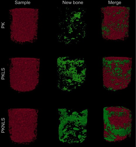 Figure 9 Reconstructed 3D images of femoral condyles on mCT at week 12 after implantation. The sample was marked by red color, while the new bones were shown in green.Abbreviations: PK: polyetheretherketone; PKNLS: polyetheretherketone–nanoporous lithium-doped magnesium silicate blend; PKLS: PK/lithium-doped magnesium silicate blend.