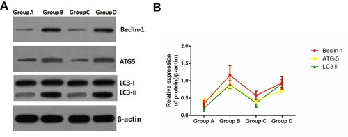 Figure 6 Effect of Apelin-13 pretreatment on the expression of autophagy-related proteins (n=8).