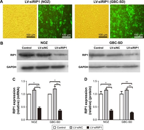 Figure 2 Establishment of RIP1-knockdown GBC cell lines.