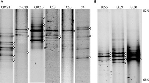 Figure 1. DGGE profiles of 16S rRNA gene fragments from Streptococcus spp. from colon biopsies (A) and bronchoalveolar lavage samples (B). White dots indicate bands further subjected to re-amplification and sequencing. The percentage of urea + formamide solution is indicated (far right)
