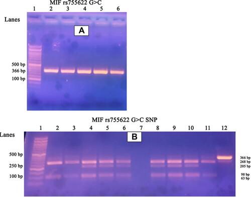 Figure 1 (A) Represents gel electrophoresis of the PCR products. Numbers refer to lanes. Lane 1 shows 50 bp DNA ladder. Lanes 2–6 showed amplified DNA segments of length 366 bp. (B) Represents detection of MIF rs755622 G>C SNP using PCR-RFLP method. Lane 1: 50 bp DNA ladder, Lane 2, 3, 11 represent wild genotypes (GG) with 268, 98 bp bands; Lane 4, 5, 6, 8, 9, 10 are heterozygous mutant (GC) genotypes with 268, 205, 98, 63 bp bands; Lane7: no template control “NTC”; Lane 12: undigested PCR product (366 bp). Homozygous mutant (CC) genotype with 205, 98, 63 bp bands could not be detected.