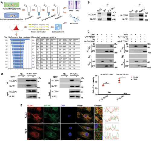 Figure 5. Zinc transporter SLC39A7 interacts with NLRX1 in NP cells. (A) the proteins that potentially interact with NLRX1 in human NP cells were immunoprecipitated with anti-NLRX1 antibody and analyzed by mass spectrometry. (B) endogenous protein immunoprecipitated (IP) from NP cells followed by western blotting, left panel: IP with anti-SLC39A7 antibody, right panel: IP with anti-NLRX1 antibody. (C) exogenous protein immunoprecipitated (IP) from 293T cells with plasmid transfection (mock GFP or HA, GFP-NLRX1, HA-SLC39A7) followed by western blotting, left panel: IP with anti-GFP antibody, right panel: IP with anti-HA antibody. (D) endogenous protein immunoprecipitated (IP) from NP cells isolated from health NP tissues following the treatments of PBS or TBHP, followed by western blotting, left panel: IP with anti-SLC39A7 antibody, right panel: IP with anti-NLRX1 antibody. (E) confocal analysis of NLRX1 and SLC39A7 with if staining in NP cells isolated from health NP tissues treated by PBS or TBHP, scale bar: 10 μm. Data are represented as mean ± SD. *p < 0.05, **p < 0.01.