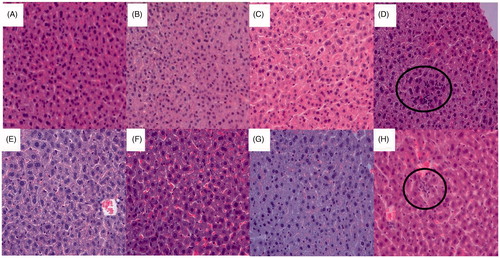 Figure 3. Liver tissue stained with hematoxylin and eosin (H&E-stained 200×) showing the effect of EtOAc fraction of O. japonicus at dose levels of 0 (A), 500 (B), 1000 (C), or 2000 (D) mg/kg in female mice, and dose level of 0 (E), 500 (F), 1000 (G), or 2000 (H) mg/kg in male mice.