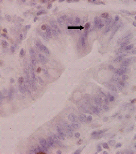 Figure 2.  Ki-67 positive cells (arrows) in the crypt of mid-jejunum in piglets fed with soybean antigens (Ki-67 immunostaining, original magnification×800).