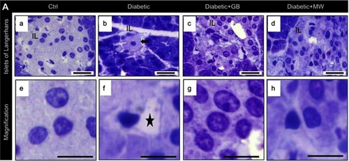 Figure 2 In the diabetic pancreas, cellular disturbances in islets of Langerhans rescued after GB and MW treatment. (A a-h) Semithin sections stained with Toluidine Blue. In diabetic rats, islets of Langerhans were smaller than Ctrl (A, B). The size of islets of Langerhans was comparable to Ctrl in GB and MW treated rats (C, D). The cells of islets of Langerhans were few in number and showed autophagy cytoplasmic vacuoles (asterisk). Scale bar 50 µm (A-D), 20 µm (E-H).