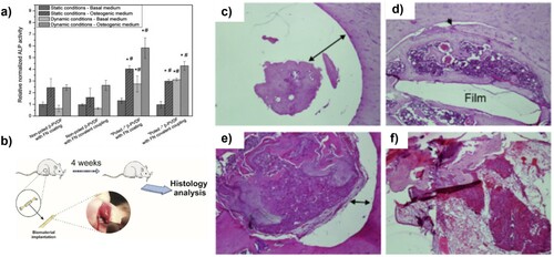 Figure 12. (a) Differentiation of hASCs on different PVDF films conditions in different media quantified by ALP assay over 15 days [Citation156]. WR specimens underwent (b) implantation of PVDF under a variety of conditions, (c) non-poled PVDF, (d) poled PVDF, (e) randomly oriented PVDF fibres and (f) no scaffold as a control scaffolds, into their femurs, after 4 weeks the femurs were exhumed and underwent H&E [Citation148]. (Reproduced from Ref [156] and [148] with permissions of John Wiley and Sons (Copyright 2014) and Elsevier (Copyright 2017) respectively).