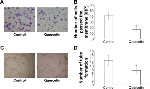 Figure 2 Quercetin inhibits U251-induced endothelial cell invasion and tube formation.