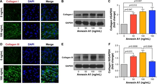 Figure 4 The effect of Annexin A1 on collagen synthesis in lung fibroblast cells.Notes: Lung fibroblast cells were treated with 0–150 ng/mL Annexin A1 for 48 h. Collagen I and collagen III production were determined by immunofluorescence staining (A and D; 400× magnification), and Western blot analysis (B and E). Analysis by densitometry of immunodetection of collagen I and collagen III using ImageJ (C and F). Results were expressed as mean ± SEM of three independent experiments.