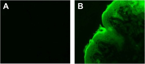 Figure 3 Fluorescence microscopy of skin sections treated with ME-T containing the fluorescent derivative of paclitaxel.Note: The images show untreated skin observed under fluorescent light to show interfering fluorescence (A) and skin treated with paclitaxel in ME-T (B).Abbreviation: ME-T, microemulsion containing transportan.