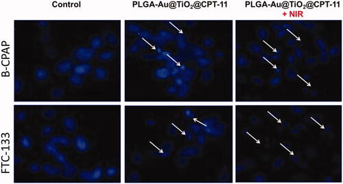 Figure 4. Nuclear staining of B-CPAP and FTC-133 thyroid cancer cell lines after treatment with PLGA-Au-TiO2@CPT-11 and PLGA-Au-TiO2@CPT-11 + NIR (IC50 concentration) for 24 h.