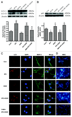 Figure 2. 3-MA inhibited IPC-induced autophagy activation in cortical neurons. Cortical neurons were pre-incubated with 3-MA (10 mM) 30 min before the onset of IPC (OGD for 30 min). After 24 h of reperfusion, a lethal OGD was induced by deprivation of oxygen and glucose for 3 h. The protein levels of LC3 and p62 were detected with immunoblotting. Levels of β-actin protein were used as the loading control. Quantitative analysis was performed with Sigma Scan Pro 5. (A) Protein expression of LC3. (B) Protein expression of p62. Bar represents mean ± SD, n = 6. *p < 0.05, **p < 0.01 compared with the control group; #p < 0.05, ##p < 0.01 compared with the OGD group; $$p < 0.05, $$p < 0.01 compared with IPC+OGD group. (C) Cortical neurons were fixed with 4% paraformaldehyde and processed for immunofluorescence. Representative images of cortical neurons were stained with DAPI (blue), and antibodies against LC3 (red) and MAP-2 (green). Note, LC3 immunostaining was upregulated in IPC and IPC+OGD groups. Bar = 10 μm. (D): The formation of autophagic vacuoles is suggested by punctate MDC staining. Cells were labeled with MDC and observed with a fluorescent microscope. Bar = 10 μm. Microphotographs were shown as representative results from three independent experiments.