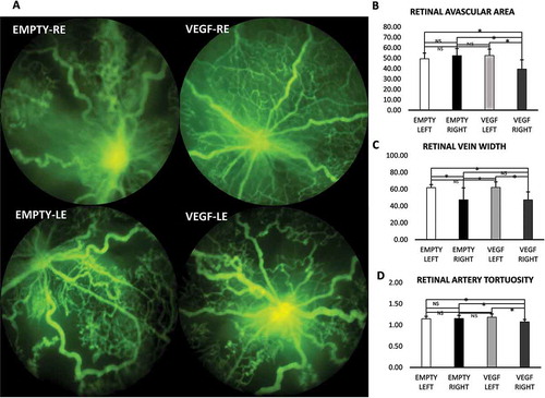 Figure 4. Quantification of in vivo fluorescein angiography in VEGF-loaded and empty microparticles.Quantification of retinal vascular parameters. A shows FA images, B shows decreased retinal avascular area, C shows reduced vein dilation, and D shows reduced arterial tortuosity.Note: RAA: retinal avascular area (%); RVW: retinal vein width (µm); RAT: retinal artery tortuosity index. All values are presented as mean ± SD.Empty represents empty microparticle injection; VEGF represents VEGF-loaded microparticle injection; RE: right eye; LE: left eye. NS denotes not statistically significant. *p < 0.05 **p < 0.01, ***p < 0.001.