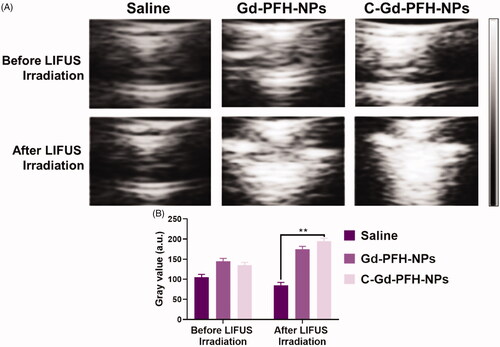 Figure 5. A) In vitro B-mode US imaging of Saline, Gd-PFH-NPs, and C-Gd-PFH-NPs before and after NIR laser irradiation. B) Gray values of B-mode US imaging of Saline, Gd-PFH-NPs, and C-Gd-PFH-NPs before and after NIR laser irradiation. **p < .01.
