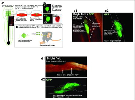 Figure 2. Rejoining severed sciatic nerves with HAP stem cells.Citation12 (a) Schematic of vibrissa follicle of GFP transgenic mice showing the position of GFP- and nestin-expressing vibrissa follicle HAP stem cells (red arrows) (a1). Colony formed from GFP-expressing HAP stem cells from the vibrissa after 2 months in culture (a2). GFP-expressing HAP stem cells within the colony were nestin-positive (a3). (b) GFP-expressing HAP stem cells grown for 2 months in DMEM-F12 containing B-27, 1% methylcellulose, and bFGF were transplanted between the severed sciatic nerve fragments in C57BL/6 immunocompetent mice (blue arrow). (c) Fluorescence images from a live mouse. Two months after transplantation between the severed sciatic nerve, the GFP-expressing HAP stem cells joined the severed sciatic nerve. (c2) Higher magnification of (c1). (d) Bright field (d1) and fluorescence (d2) images of an excised sciatic nerve.