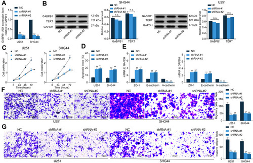 Figure 2 GABPB1-AS1 knockdown suppresses growth of glioma cells. (A) transfection efficacy of shRNA-#1 and shRNA-#2 of GABPB1-AS1 in U251 and SHG44 cells examined by RT-qPCR; (B) protein levels of GABPB1 and TERT in U251 and SHG44 cells examined by Western blot analysis; (C) viability of cells after GABPB1-AS1 knockdown determined by the CCK-8 method; (D) apoptosis rate of U251 and SHG44 cells after GABPB1-AS1 knockdown examined by flow cytometry; (E) expression of EMT-related markers ZO-1, E-cadherin and N-cadherin in U251 and SHG44 cells after GABPB1-AS1 inhibition quantified by RT-qPCR; (F and G) migration (F) and invasion (G) abilities of U251 and SHG44 cells after GABPB1-AS1 downregulation detected by Transwell assays. Data were collected from three independent experiments and expressed as the mean ± SD. Data were analyzed by two-way ANOVA. **p < 0.01.