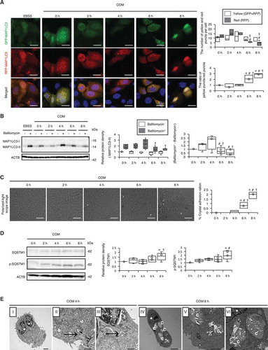 Figure 2. Autophagy is impaired upon exposure of renal tubular cells (RTCs) to CaOx monohydrate (COM) crystals. (A) Number of yellow (GFP + RFP) and red (RFP) puncta per cell and ratio of yellow:red puncta in RTCs with COM exposure transfected with tandem fluorescent-tagged LC3 (tfLC3). At least 30–50 cells were counted (n = 3). For starvation treatment, we cultured cells with Earle’s balanced salt solution (EBSS) for 2 h without COM. (B) Relative protein density and difference of MAP1LC3-II (bafilomycin+) and MAP1LC3-II (bafilomycin−), determined by western blotting (MAP1LC3) of RTCs with COM exposure and bafilomycin A1 (n = 5). (C) Adhesion ratio in polarized-light scope images of RTCs after COM exposure. Images were obtained from 10 random fields. At this resolution there were 200–300 cells per field (n = 3). (D) Relative protein density, determined by western blotting (SQSTM1 and p-SQSTM1) of RTCs with COM exposure (n = 5). (E) TEM images (at 4 h and 8 h after COM exposure). Asterisks indicate the nucleus, and arrows indicate phagophore and autolysosomes. C, crystal. Scale bars: 50 μm (C), 20 μm (A), 5 μm (E; I and IV), 2 μm (E; II and V), 1 μm (E; III and VI). Values at 0 h and bafilomycin− 0 h were adjusted to ‘1’ as a reference (A, B, D). *P < 0.05 versus 0 h, #P < 0.05 versus 2 h, †P < 0.05 versus 4 h.