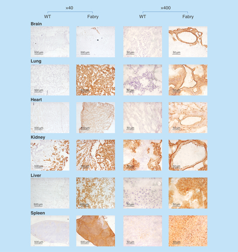 Figure 6.  Tissue-wide accumulation of globotriaosylceramide in Fabry mice.Tissue globotriaosylceramide levels were evaluated by histochemical staining using verotoxin. Sections were treated with MCD to deplete cholesterol. Staining was markedly higher in Fabry tissues and was observed throughout the tissue sections.MCD: Methyl-β-cyclodextrin; WT: Wild-type.