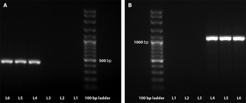 Figure 4. PCR amplification of DNA from paraffin-embedded liver sections of the turkeys infected with Mycobacterium avium subsp. avium. The 427-bp specific fragment from IS1245 (A) and the 1108-bp specific fragment from IS901 (B) are shown in relation to molecular size marker with 100 bp rungs. L1 and L2, negative controls (no template added); L3, Mycobacterium bovis AN5 strain (ATCC 35726) (amplification product was not obtained); L4, Mycobacterium avium subsp. avium D4 strain (ATCC 35713) (amplification product was obtained); L5 and L6, double-checked samples tested for Mycobacterium avium subsp. avium (amplification product was obtained).
