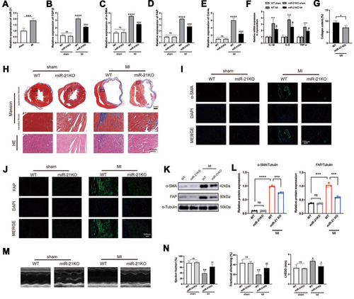 Figure 1 miR-21 promotes post-myocardial infarction (MI) cardiac fibrosis and negatively impacted cardiac function. (A) Expression profile of miR-21 at 2 weeks post-MI; ***P < 0.001, n = 5 per group. (B–E) Knockout (KO) of miR-21 decreases the expression of TGF-β, α-SMA, FAP and Col-Iα at 2 weeks post-MI; ****P<0.0001 compared with WT sham, ####P<0.001 compared with wild-type (WT) MI, n = 5 per group. (F) KO of miR-21 decreases the expression of inflammatory cytokines at 2 weeks post-MI; ***P < 0.001 compared with WT sham, #P < 0.05 compared with WT MI, n = 5 per group. (G) Quantitative analysis of collagen content between WT and miR-21 KO mice at 2 weeks post-MI based on Masson’s trichrome staining; *P < 0.05, n = 3 per group. (H) Representative Masson’s trichrome and H&E staining of the cross section of the heart. The representative illustration indicates that miR-21 KO attenuates both replacement fibrosis and interstitial fibrosis in the infarct border zone. (I and J) Representative immunofluorescence staining of α-SMA and FAP in the heart; scale bars = 100 µm. (K and L) Western blotting analysis of α-SMA and FAP in WT and miR-21 KO mice myocardium. Left panel (K), representative blots; right panel (L), quantitative analysis; ns = not significant, ***P < 0.001 and ****P < 0.0001, n = 3 per group. (M and N) Representative (M) and quantitative analysis of cardiac functions at 2 weeks post-MI (N); ns = not significant, *P < 0.05 and **P < 0.01 compared with WT sham, #P < 0.05 and ##P < 0.01 compared with WT MI, n = 4 per group.