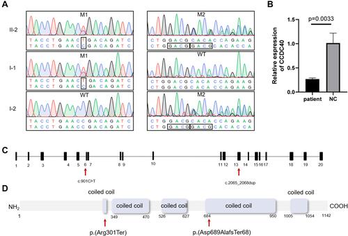Figure 2 (A) Sanger-sequencing chromatograms and co-segregation analysis for patient’s family. Mutation 1 (NM_017950.3:c.901C>T, p.(Arg301*)) and mutation 2 (NM_017950.3:c.2065_2068dup, p. (Ala690Glyfs*67)) were identified in patient’s family. (B) Expression levels of CCDC40 are verified using RT-qPCR. A significantly reduced expression of CCDC40 is observed in the peripheral blood from the patient. (C and D) Location of CCDC40 mutations identified in this study are shown with arrows in the gene and protein. Predicted protein domains (coiled coil domains) are indicated by rectangles.