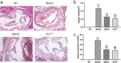 Figure 1. Effects of Si-Miao-Yong-an (SMYA) on aortic root plaque stability and the ratio of PA/LA in mice. (a) HE staining was used to observe as in ApoE−/− mice treated with SMYA. In the model group, the aortic intima was significantly thickened, as plaques were formed, a large number of foam cells, cholesterol crystals and lipids accumulated in the plaques, and plaques ruptured and bled. After the intervention of SMYA, the plaque area was reduced, the foam cell infiltration in the plaque was alleviated, the cholesterol crystals and lipid accumulation were reduced, and the degree of intimal thickening was mild (optical microscope, ×100). (b) after the intervention of SMYA, the ratio of aortic plaque area (PA) was significantly decreased. (c) after the intervention of SMYA, the ratio of aortic plaque area (PA) to lumen area (LA) (PA/LA) was significantly decreased. Data are shown as mean ± SD. **p < 0.01, compared with the normal control (NC) group. ##p < 0.01, compared with the model group.