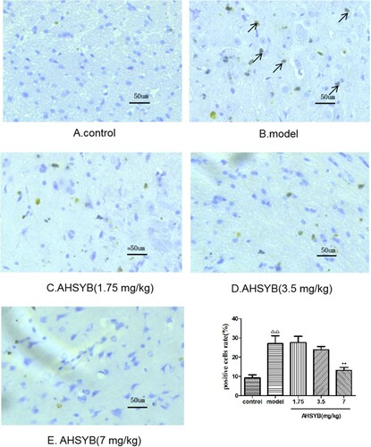 Figure 6. Effect of AHSYB on HSP60 ptotein expression in cerebral cortex of rats with acute permanent cerebral ischemia by immunohistochemistry staining (n = 6, positive as brown, original magnification 10). ΔΔp < .01 versus control group,** p < .01 versus model group.