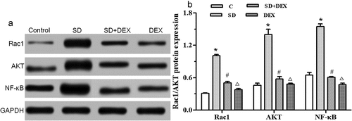 Figure 5. Protein expressions of Rac1/AKT/NF-κB in the hippocampus. (a) Protein expression detected by Western blotting; (b) relative protein expression. *P < 0.05 vs. C group; #P < 0.05, ∆P < 0.01 vs. SD group. GAPDH: Glyceraldehyde 3-phosphate dehydrogenase