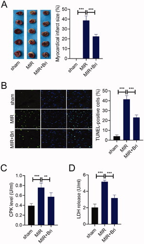 Figure 1. Bri protected against MIR injury. SD rats were intragastrically administered with Bri, followed by undergoing MIR surgery. (A) Representative images and quantification of myocadiac infarction area in the sham, MIR, and MIR + Bri group. (B) Representative images and quantification of myocardial apoptosis in the sham, MIR, and MIR + Bri group. (C and D) Commercial kits were used to analyse the levels of serum CPK and LDH in the sham, MIR, and MIR + Bri group. **p < 0.01 and ***p < 0.001.