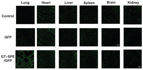 Figure S5 In vivo GFP analysis in different organs after aerosol administration.Abbreviations: GFP, green fluorescent protein; GT–SPE, glycerol triacrylate–spermine.
