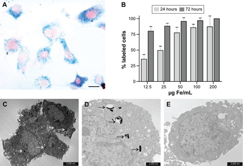 Figure 1 Intracellular uptake of USPIO.Notes: (A) Prussian blue staining of ASCs to detect the presence of iron nanoparticles after USPIO incubation. The image clearly shows a red nucleus and a blue cytoplasmic inclusion with typical perinuclear localization that indicate the presence of USPIO within the cells (magnification ×20, scale bar 50 µm). (B) Percentage of labeled cells after 24 hours and 72 hours of incubation with USPIO. Data expressed as mean ± SD. (C and D) TEM images of ASC incubated for 72 h with 200 µg Fe/ml of USPIO. In C, the scale bar is 5,000 nm; in D note the endocytic invagination containing nanoparticles and the internalized nanoparticles inside the endosome (scale bar 2,000 nm). In C and D arrows indicate the presence of nanoparticles inside the cell. (E) TEM image of unlabeled ASCs as negative control (scale bar 5,000 nm).Abbreviations: ASC, adipose stem cell; TEM, transmission electron microscopy; USPIO, ultrasmall superparamagnetic iron oxide nanoparticles.