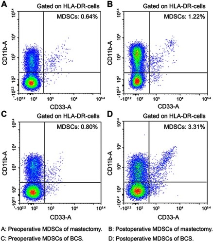 Figure 3 Representative dot plots of the population of MDSCs for different surgical methods. (A) Preoperative MDSCs of mastectomy. (B) Postoperative MDSCs of mastectomy. (C) Preoperative MDSCs of BCS. (D) Postoperative MDSCs of BCS.Abbreviations: BCS, breast-conserving surgery; MDSCs, myeloid-derived suppressor cells.