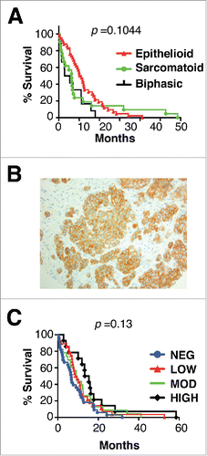 Figure 1. Histology, MET receptor expression and survival analysis of patients with malignant pleural mesothelioma. (A) Kaplan Meier plot for survival of patients with mesothelioma of the specified histologic subtypes. (B) Representative example of MET staining pattern seen in mesothelioma tissue microarray sections. Magnification × 200. (C) Kaplan Meier plots for survival of patients with mesothelioma according to level of expression of MET. p value was generated by Log-rank (Mantel Cox) test.