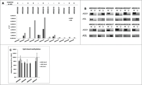 Figure 2. Expression levels and methylation profile of ASS1 and ASL in a panel of GBM cell lines. (A) Quantitative SYBR Green-1-based PCR to detect ASS1 and ASL expression in GBM cell lines. Expression was normalized to a housekeeping gene (GAPDH). Expression levels are given as 2^-dCt. (B) MSP of ASS1 and ASL as described in material and methods. Methylation profile of these 2 genes in GBM cell lines was assessed by using one primer set for ASL (Set 1) and 2 different primer sets for ASS1 (Set 2 and Set 4), representing distinct CpG islands. For ASS1, results for Set 2 are shown. (C) Quantitative MSP of CpG islands within ASS1 and ASL, respectively. Results show the methylation level of GBM cell lines with high sensitivity toward ADI. SSS1-treated leukocytes were set as 100 % and all other data were given as % vs. SSS1. Values are given as the relative expression ± SD from 3 independent replicates.