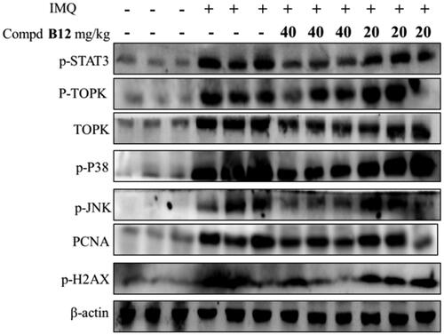 Figure 9. Compound B12 inhibited expression of p-STAT3, p-TOPK, TOPK, p-p38, p-JNKs, PCNA, p-H2AX in mouse skin tissues. The results were showed as means ± SD (n = 3) of at least three independent experiments.