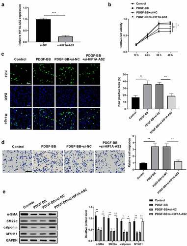 Figure 2. Knockdown of HIF1A-AS2 suppressed SMCs proliferation and migration, while promoted phenotypic switching. (a) The expression of HIF1A-AS2 was detected by qRT-PCR in si-HIF1A-AS2-transfection SMCs. (b) The effect of si-HIF1A-AS2 on SMCs viability was determined by CCK-8 assay. (c) The effect of si-HIF1A-AS2 on Ki67 positive cells was measured by Immunofluorescence assay (Scale bar = 50 μm). (d) The effect of si-HIF1A-AS2 on cell migration was detected by transwell assay (Scale bar = 50 μm). (e) The effect of si-HIF1A-AS2 on α-SMA, SM22α, calponin, and MYH11 protein levels were examined by Western blotting. *P < 0.05,** P < 0.01, *** P< 0.001.