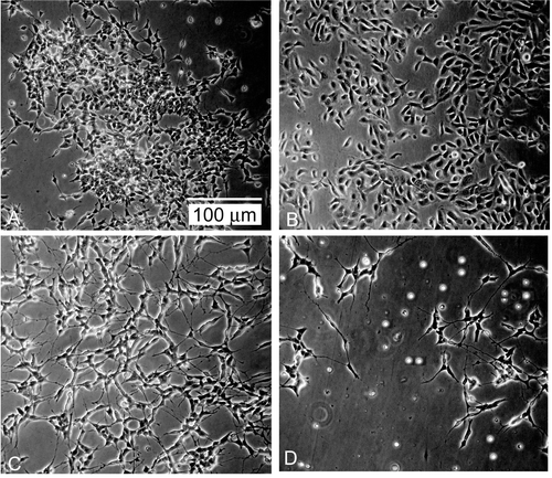 Figure 5.  Morphologic appearance of LAN-5 cell cultures after 72 h of treatment. (A) control; (B) pure polymer (36 μM); (C) pure ATRA (5 μM); (D) complexed ATRA (5 μM). Bar = 100 μm. One representative experiment out of three performed is shown.