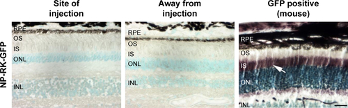 Figure S3 GFP protein is not detected in NP-RK-GFP SR–injected eyes.Notes: Sections from an eye injected at one site with NP-RK-GFP (#14L) in the quadrant of injection (left) and away from the quadrant of injection (middle) were incubated with GFP antibody (purple) and counterstained with methyl green (teal). Sections from a transgenic mouse expressing GFP under a photoreceptor-specific promoter (retbindin) were used as a positive control (right). Arrow indicates GFP expression in the IS of photoreceptors from the positive control mouse. Images captured at 40×. Images are from animal 14L. Scale bar 25 µm.Abbreviations: SR, subretinal injection; INL, inner nuclear layer; IS, inner segment; ONL, outer nuclear layer; OS, outer segment; RPE, retinal pigment epithelium.