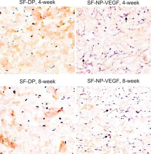 Figure 8 Immunohistochemical staining of macrophages. The macrophages were stained by anti-CD68 antibody, original magnification × 100.Note: The arrows indicated red staining cells are macrophages.Abbreviations: CD68, cluster of differentiation molecule 68; DP, decellularized scaffolds; NP, nanoparticle; SF, scaffolds; VEGF, vascular endothelial growth factor