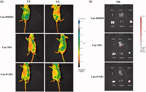 Figure 10. Biodistribution imaging of Cur-loaded carriers in MCF-7-inoculated athymic nude mice after i.v. injection. (a) The whole body and (b) the main organs.