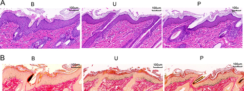 Figure 2 H&E and Masson staining (× 100). (A) H&E staining was used to detect the pathological changes of Guinea pig skin. (B) Masson staining was used to detect melanin deposition in Guinea pig skin tissue. B group: blank group, U group: an ultraviolet radiation, P group: a combination of progesterone injection and ultraviolet radiation.