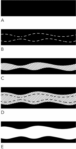 Figure 9. Void design strategy 2: (A) solid block; (B) solid block with cutting lines; (C) removal of the solid matter between the cutting lines to create an initial void; (D) separation of both halves to expand the void; (E) final composition of solid and void. Source: graphic by author.