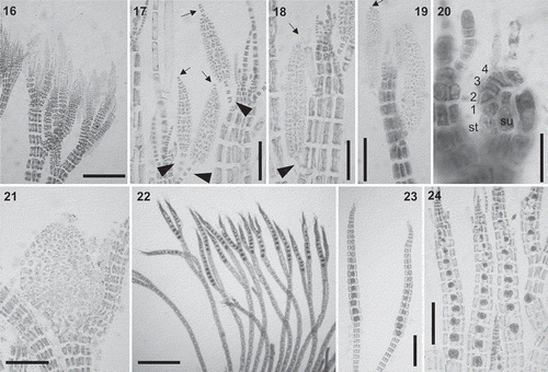 Figs 16–24. Vertebrata cymatophila (17, 18, 22, 24) and V. barbarae sp. nov. (16, 19–21, 23): Reproductive morphology. Fig. 16. Apical branches bearing abundant spermatangial branches. Figs 17–19. Spermatangial branches with 1–5 basal (arrowheads) and 0–4 apical (arrows) sterile cells. Fig. 20. Procarp showing the supporting cell (su), the sterile basal cell (st) and the four-celled carpogonial branch (1–4). Fig. 21. Cystocarp. Figs 22–24. Apical branches with tetrasporangia. Scale bars: Figs 16, 21, 24 = 150 µm; Figs 17–19 = 70 µm; Fig. 20 = 20 µm; Figs 22–23 = 200 µm