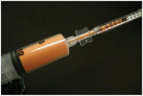 Figure 8 Anaerobic luer-to-luer transfer shown loading adipose graft to 1 cc treatment syringe.