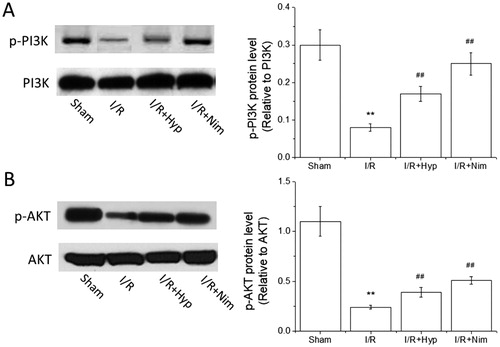 Figure 5. Effects of hyperoside on the expression of p-PI3K and p-AKT proteins in the brain tissue of I/R rats (x¯ ± SD, n = 8). p-PI3K protein level (A); p-AKT protein level (B). **P < 0.01, vs the sham group; ##P < 0.01, vs I/R group.