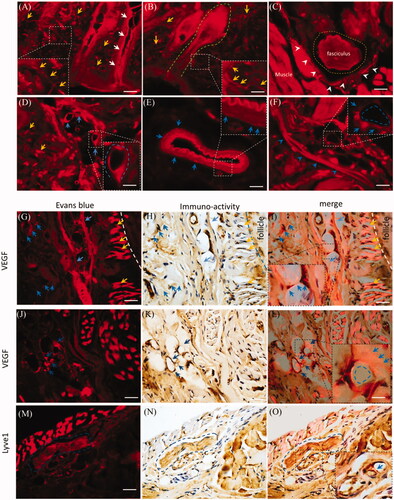 Figure 6. Dermal EB distributed along vasculatures and the perivascular spaces. The EB distribution was observed in the mystacial pad at 2.0 h-post injection and the sections from edge of injection site. (A) and (B) Evans blue diffused into the mystacial sweat glands and hair follicles. (C) EB distributed in the fasciculus and the perineurium. (D) and (E) Evans blue diffused along endothelial cells and perivascular tissues. (F) Evans blue distributed along the lymphatic vessel and blood capillary. (G–L) EB overlaid or surrounded VEGF immuno-reactivity. (M–O) EB located around the Lyve1 immuno-reactivity. White arrows: the sweat gland; green dash line: hair follicle; yellow arrows or dash circle: the sensory nerve fibers and fasciculus; blue arrows or dash circles: vasculatures and perivascular spaces or tissues; white arrowheads: the perineurium. The bar is 50 μm, (A–F) 20×, (G–O) 40×.