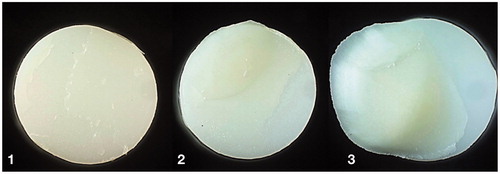Figure 3. Examples of fracture morphology observed in light microscope (diameter 5 mm). 1: combination of cohesive fracture in cement and adhesive fracture between cement-zirconia; 2: combination of cohesive fracture in dentin and adhesive fracture between cement-dentin and cement-zirconia; 3: combination of cohesive fracture in dentin and cement, and adhesive fracture cement-zirconia.