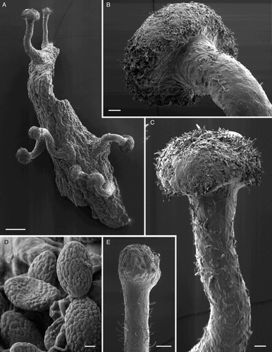 Figure 7. Scanning electron micrographs of Chaenothecopsis schefflerae (Holotype, PDD42005). A, Ascomata; B, Capitulum. C, Stipe surface. D, Ascospore. E, Semi-mature capitulum. Scale bars 200 µm (A), 50 µm (E), 20 µm (B,C), 1 µm (D).