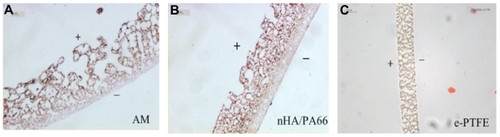 Figure 1 (A) Microscopic section of the Ag-nHA-nTiO2/PA66 (AM) membrane (H&E ×100); (B) microscopic section of the nHA/PA66 membrane (H&E ×100); (C) microscopic section of the e-PTFE membrane (H&E ×200).Notes: +, the observe; –, the reverse.Abbreviations: e-PTFE, expanded poly tetrafluroethylene; H&E, hematoxylin and eosin stain; PA66, polyamide-66.